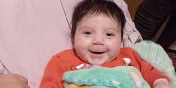 La pequeña de 5 meses debe ser operada nuevamente por una cardiopatía muy compleja. Estudio médico.