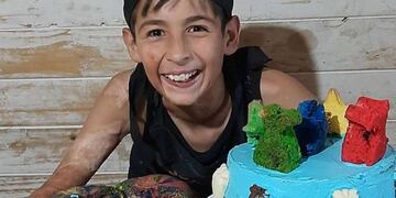Joaquín Nahuel, quien ahora tiene 13 años, se hizo viral por vender tortas para la operación de piel que necesita.