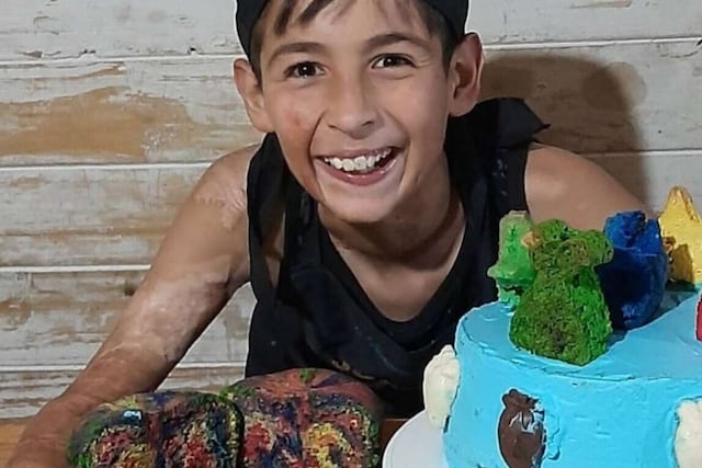 Joaquín Nahuel, quien ahora tiene 13 años, se hizo viral por vender tortas para la operación de piel que necesita.