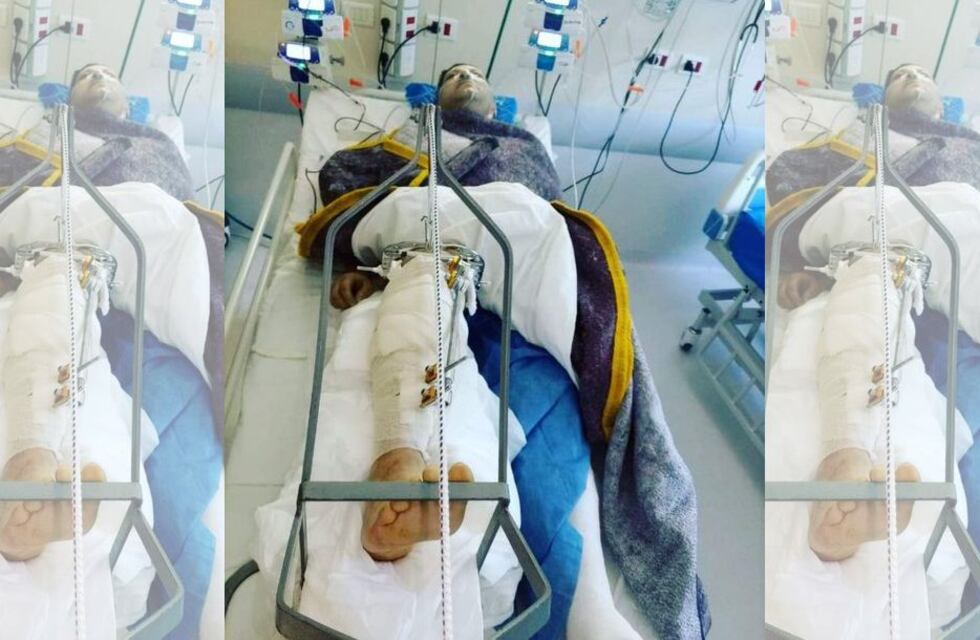 Lo atropellaron mientras cambiaba un neumático y lo dejaron tirado en la ruta