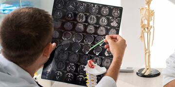 Gimena sufre un trastorno del cerebro y del sistema nervioso y necesita ser atendida urgente. (Imagen ilustrativa).