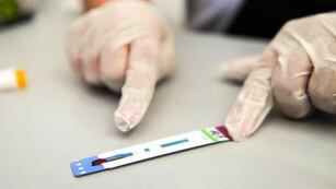 El test es gratuito, seguro y confidencial