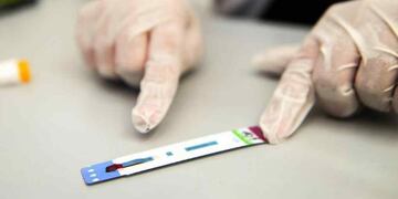 El test es gratuito, seguro y confidencial