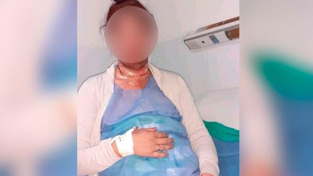 Denunció que intentaron violarla y prenderla fuego.