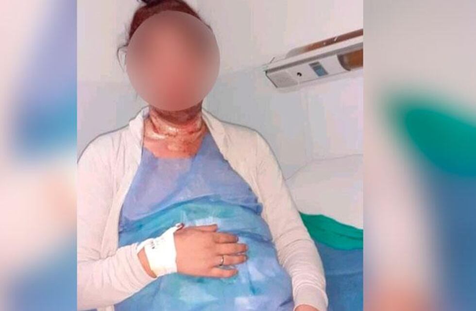 Transfobia en Córdoba: la mujer a quien prendieron fuego contó detalles del ataque