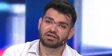 Internaron de urgencia a Fran Mariano, el ex cuestión de peso que quería parecerse a Ricky Martin.