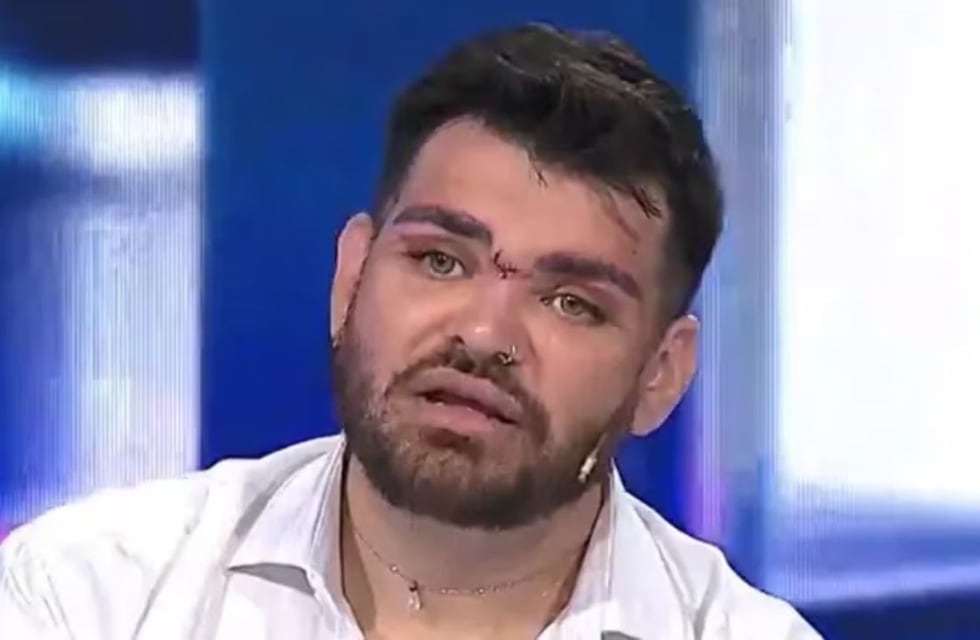 Internaron de urgencia a Fran Mariano, el ex cuestión de peso que quería parecerse a Ricky Martin