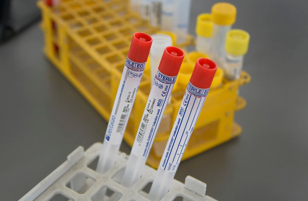 Coronavirus en Tandil: hay 50 casos activos en la ciudad