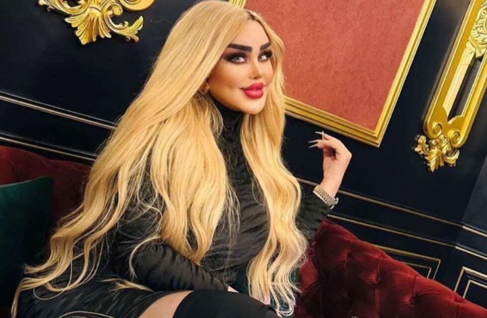 Es viral: una mujer quiso ser como Barbie, se sometió a 43 cirugías, pero quedó irreconocible