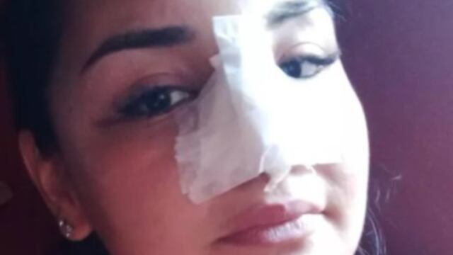 Su novia se negó a entregarle sus ahorros y el la agredió brutalmente