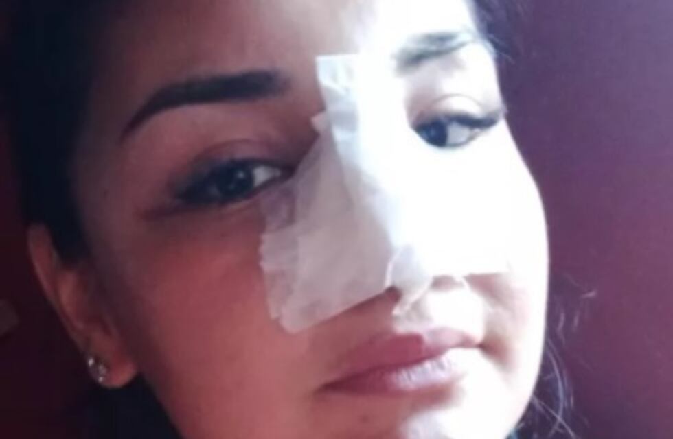 Su novia se negó a entregarle sus ahorros y el la agredió brutalmente