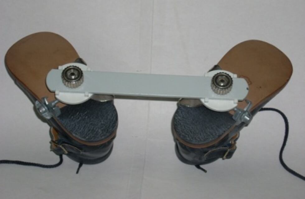 Nació con Pie Bot y realizan una campaña para conseguirle un zapato especial