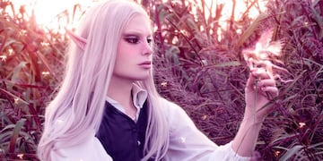 Quién es “El elfo formoseño”, el joven que quiso cambiar su imagen y gastó más de 30 mil dólares en cirugías.