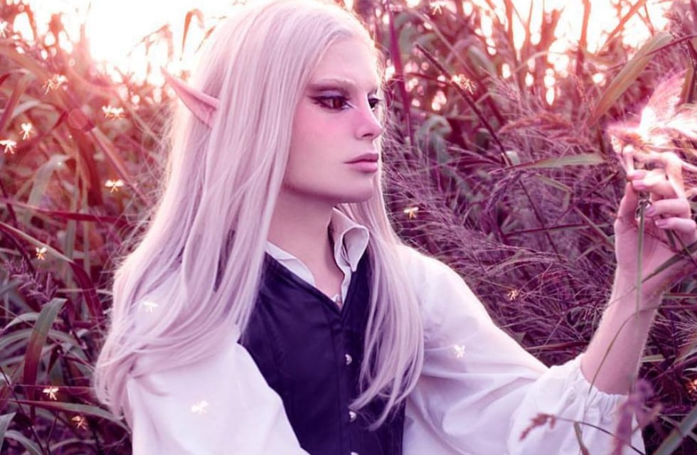 Quién es “El elfo formoseño”, el joven que quiso cambiar su imagen y gastó más de 30 mil dólares en cirugías