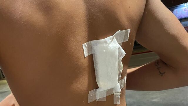 El joven de 16 años fue apuñalado por la espalda dentro de un boliche.