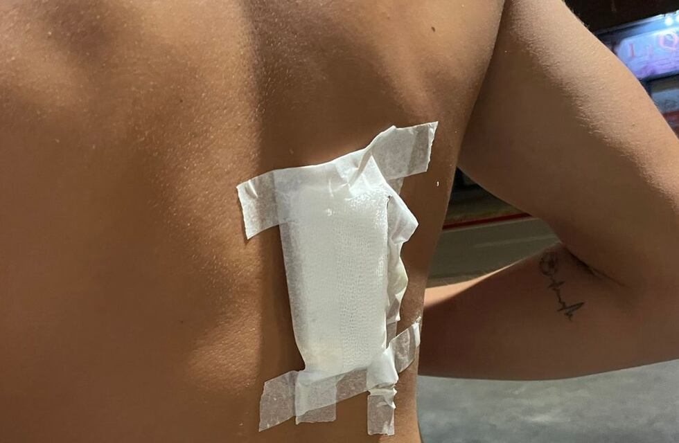 “La noche da miedo”: las repercusiones de la puñalada a un adolescente en un boliche de Córdoba