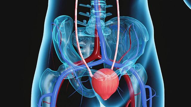 El cáncer de vejiga es más frecuente en hombres que en mujeres y la edad promedio en la que se presenta es a los 70 años. (Sanatorio Allende)