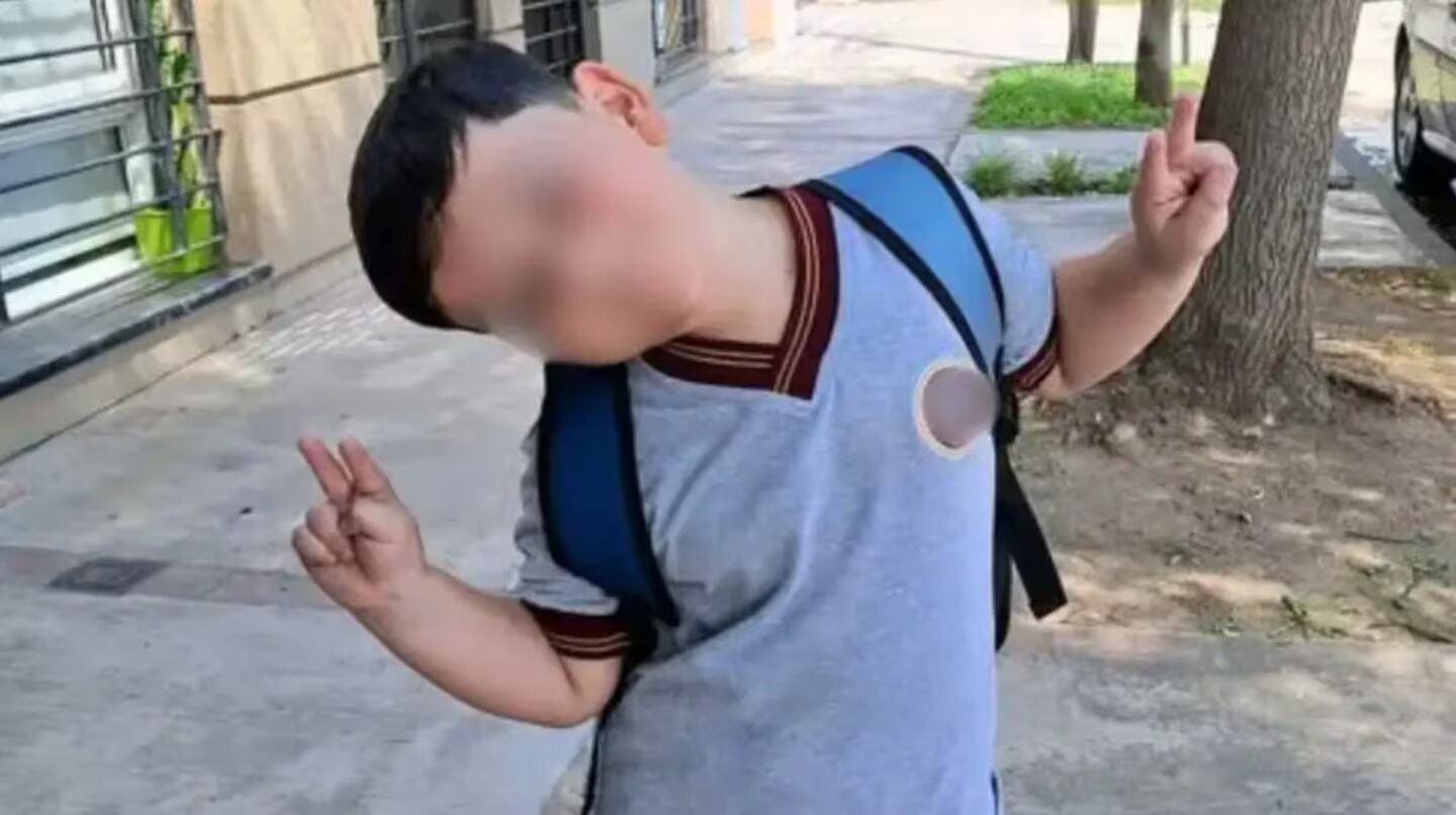 El nene de ocho años que sufrió el accidente en Pinamar