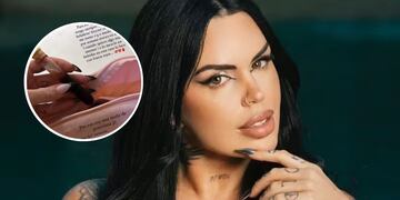 De qué se trata el tratamiento que se hace Sofía Clerici y por qué toma sangre una vez por semana