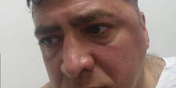 El director técnico de Bancario denunció que jugadores de Olympia lo golpearon y lo patearon en el piso.