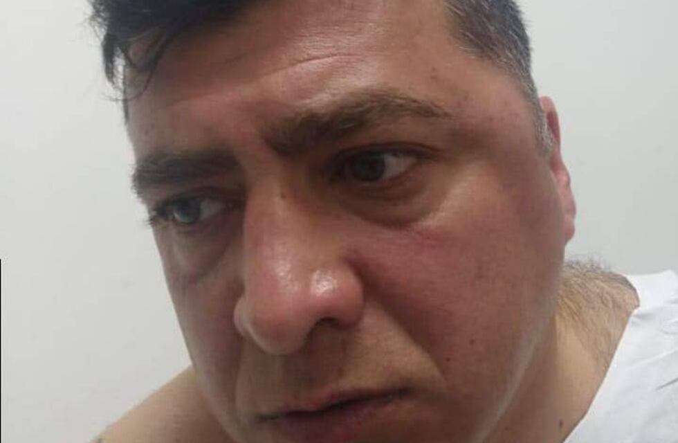Le quebraron la mandíbula a exjugador de Central que dirige en Liga Rosarina