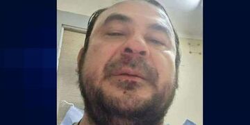 El doctor Juan Carlos Cajal tras la agresión.