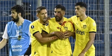 Un jugador de Peñarol fue herido por un proyectil