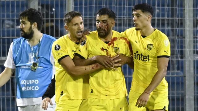 Un jugador de Peñarol fue herido por un proyectil