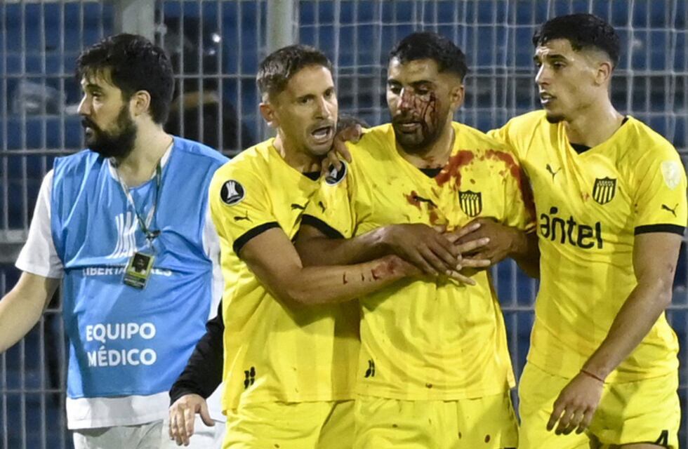 Disturbios tras el partido de Rosario Central: hinchas agredieron a jugadores de Peñarol