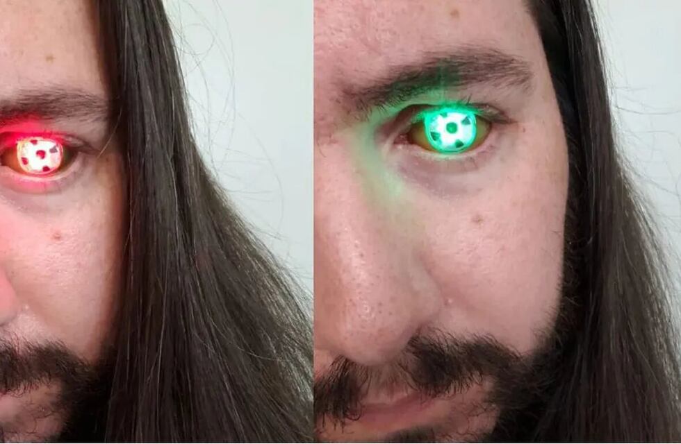 Perdió un ojo por un cáncer y decidió reemplazárselo por una linterna LED