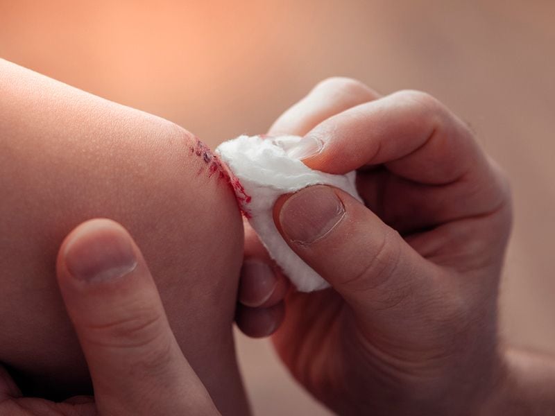 Cómo cuidar la piel del bebé: los tips para tener sana y libre de molestias