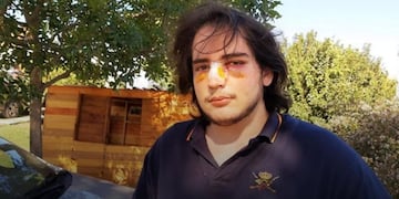 Lautaro Insúa, el joven golpeado