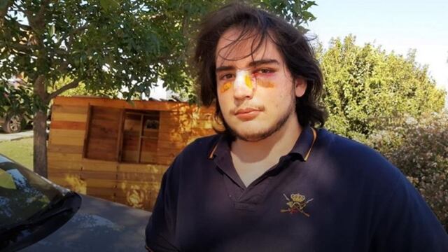 Lautaro Insúa, el joven golpeado