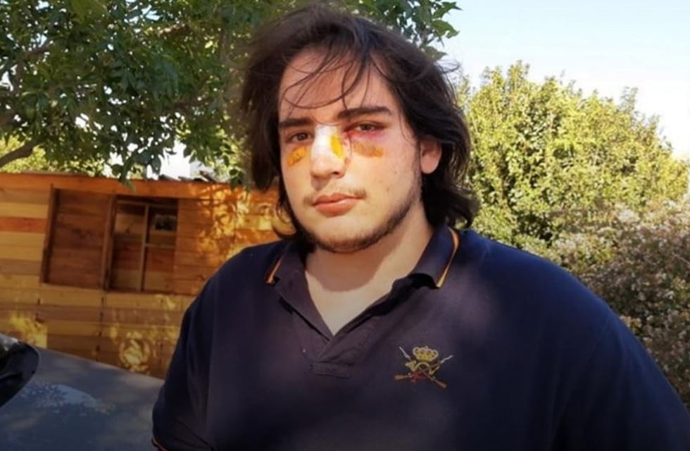 Córdoba: agravaron la acusación de los dos rugbiers imputados por golpear a un joven