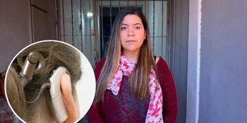 La cordobesa de 27 años que sufrió el robo de su aparato coclear este miércoles en la ciudad.