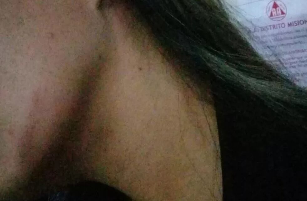 Una joven denunció un ataque por parte de un efectivo policial