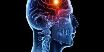 Hospital Schestakow tendrá una unidad especializada en atender pacientes con ACV