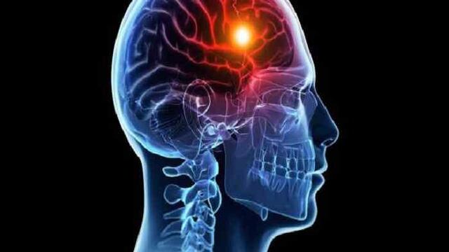 Hospital Schestakow tendrá una unidad especializada en atender pacientes con ACV