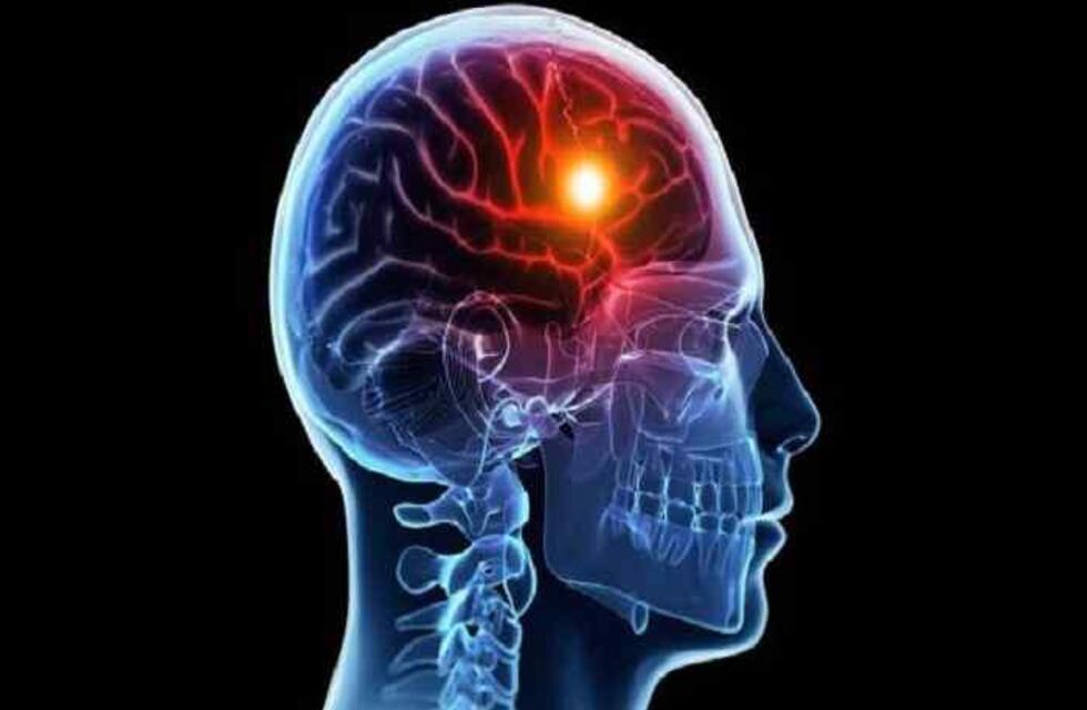 El Hospital Schestakow tendrá una unidad especializada en atender pacientes con ACV