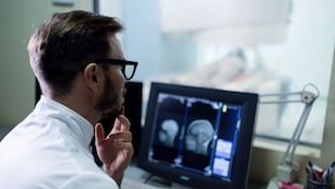 Todo lo que hay que saber sobre el ACV y su recuperación.