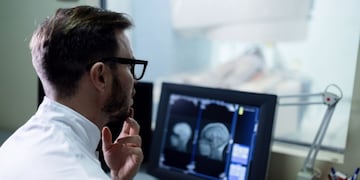 Todo lo que hay que saber sobre el ACV y su recuperación.