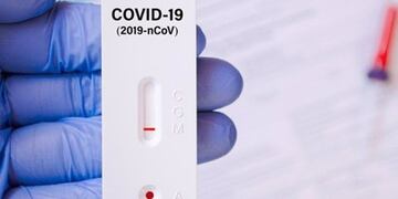 Los autotest para detectar coronavirus se aplican en varios países alrededor del planeta desde hace un tiempo ya.