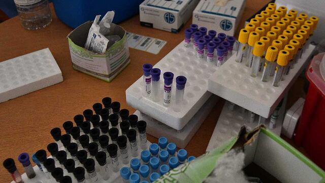 Casos de Covid – 19: Reporte diario