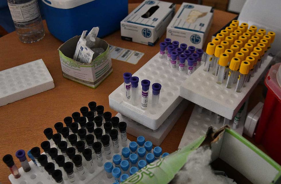 Casos de Covid – 19: Reporte diario