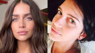 Uno por uno: todos los retoques estéticos que Zaira Nara jamás mencionó, según especialistas en medicina estética.