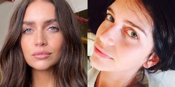 Uno por uno: todos los retoques estéticos que Zaira Nara jamás mencionó, según especialistas en medicina estética.