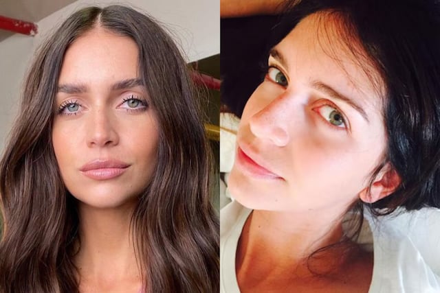 Uno por uno: todos los retoques estéticos que Zaira Nara jamás mencionó, según especialistas en medicina estética.