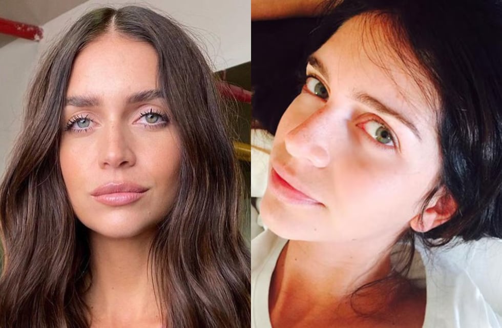 Uno por uno: todos los retoques estéticos que Zaira Nara jamás mencionó, según especialistas en medicina estética
