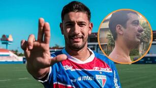 Eros Mancuso, acusado de morder a un vecino en Brasil