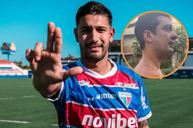 Eros Mancuso, acusado de morder a un vecino en Brasil